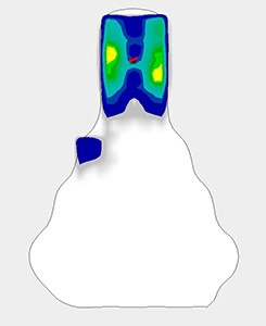 gebioMized Stride