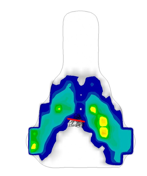 Gebiomized Area