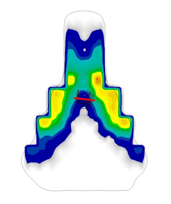 Gebiomized Area